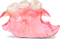 PERFLEX Acetal PERFLEX Acetal