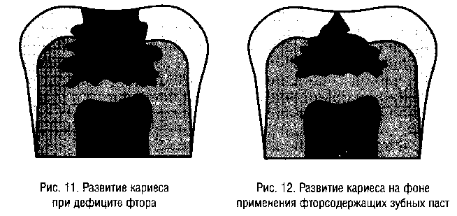 pts111.jpg